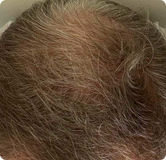 WEEKS 8-12