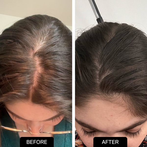 Peptide Shampoo and Serum Longevity Stack
