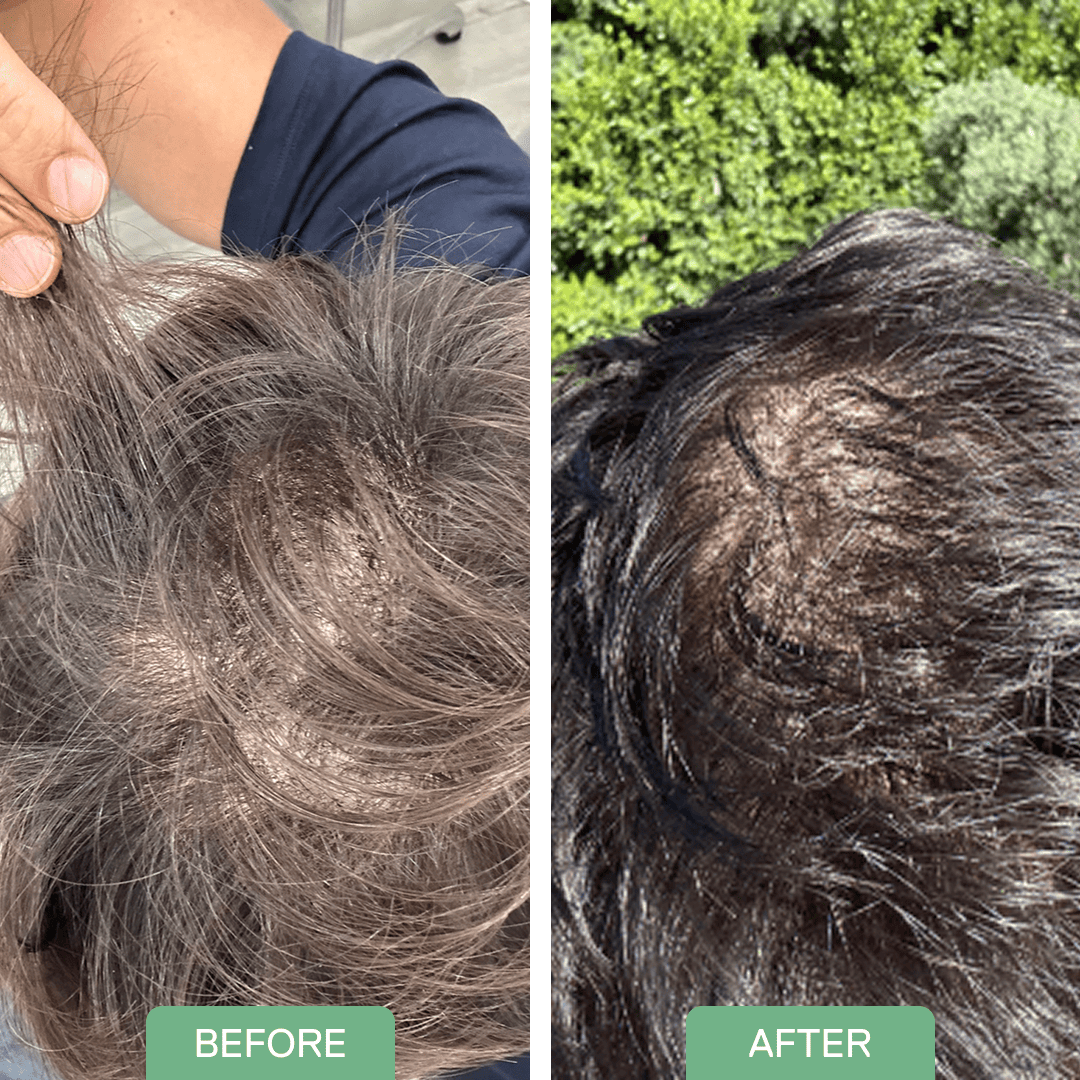 Before and after — Jeff B.