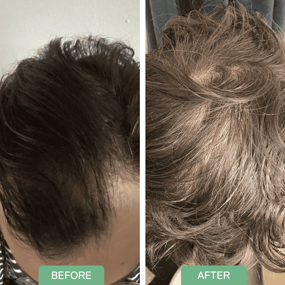 Before and after — Derek