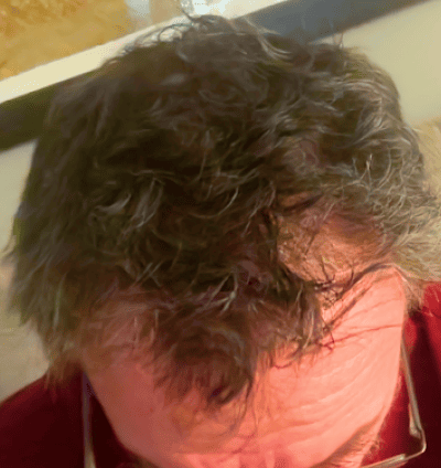 After